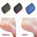 Glass Foot File Callus Remover - Foot Scrubber Heel Scraper for Dead Skin Removal, Foot Buffer Shower Pedicure Tool for Men, Women, Soft Feet Care